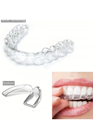 515 Bruksizm Gece Aparatı Plağı… 515 Bruksizm Gece Aparatı Plağı…