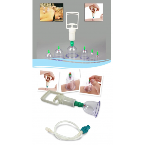 Hacamat Seti Hortumlu - Vakumlu Hortumlu Kupa Çekme Seti 14 Parça