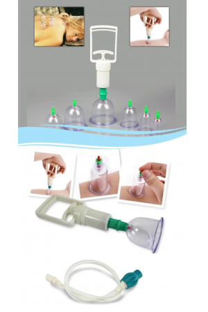 Hacamat Seti Hortumlu - Vakumlu Hortumlu Kupa Çekme Seti (model 3)&hellip;