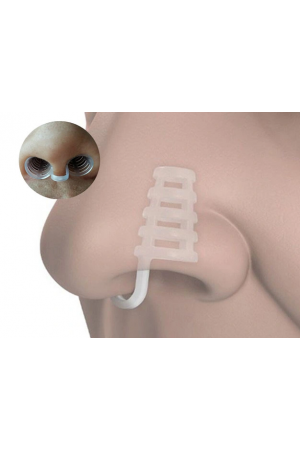 Horlama Burun Aparatı - Kafesli…