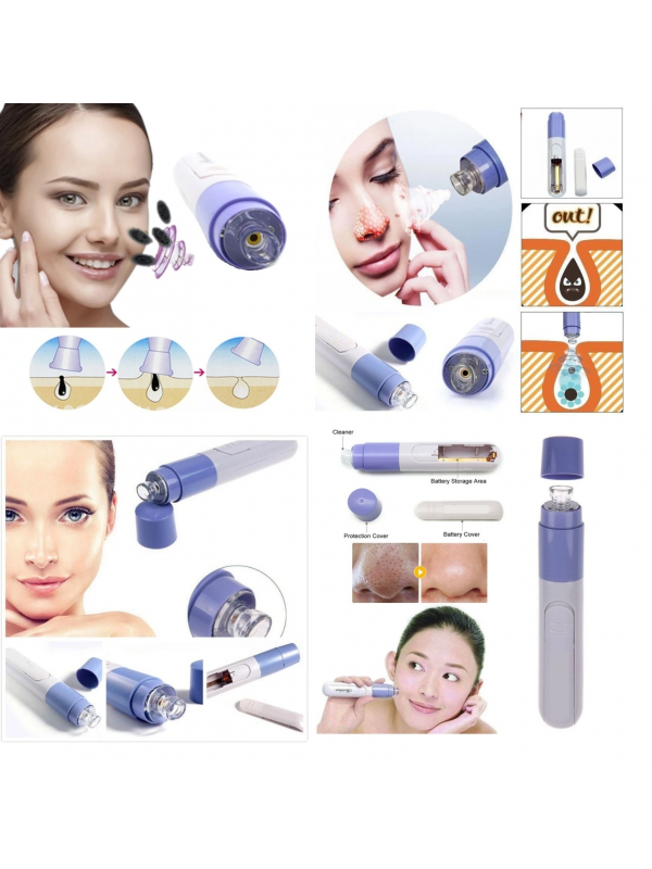 Siyah Nokta Temizleme - Yüz Temizleme Cihazı Vakumlu Siyah Nokta Temizle… Siyah Nokta Temizleme - Yüz Temizleme Cihazı Vakumlu Siyah Nokta Temizle…