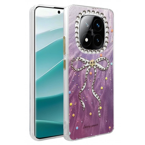 LRZ02 Xiaomi Redmi Note 14 Pro 4G Kılıf Blade Aynalı Desenli Kapak - Desen 1