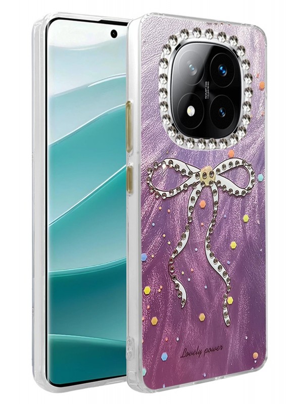 LRZ02 Xiaomi Redmi Note 14 Pro 5G Kılıf Blade Aynalı Desenli Kapak - De&hellip;