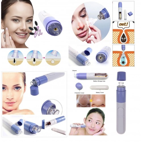 Siyah Nokta Temizleme - Yüz Temizleme Vakumlu Siyah Nokta Temizleme Siyah Nokta Temizleme - Yüz Temizleme Vakumlu Siyah Nokta Temizleme