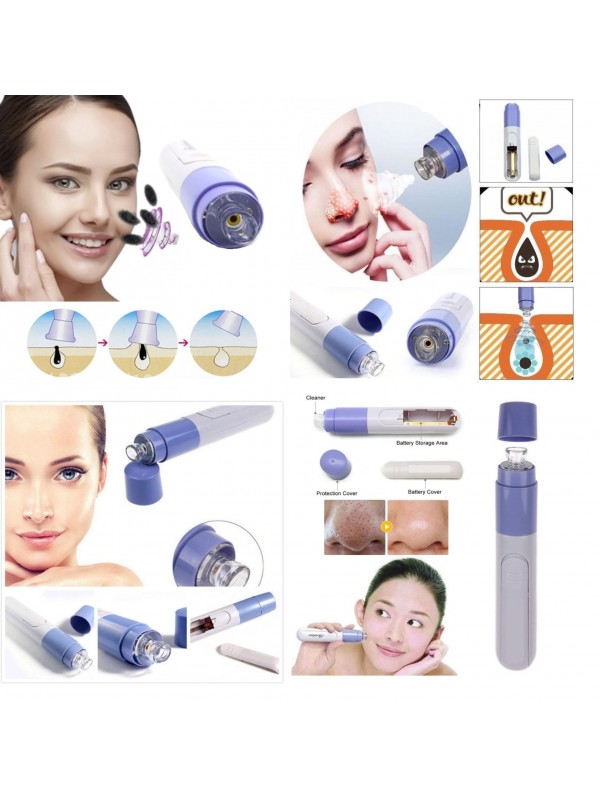 Siyah Nokta Temizleme - Yüz Temizleme Vakumlu Siyah Nokta Temizleme… Siyah Nokta Temizleme - Yüz Temizleme Vakumlu Siyah Nokta Temizleme…